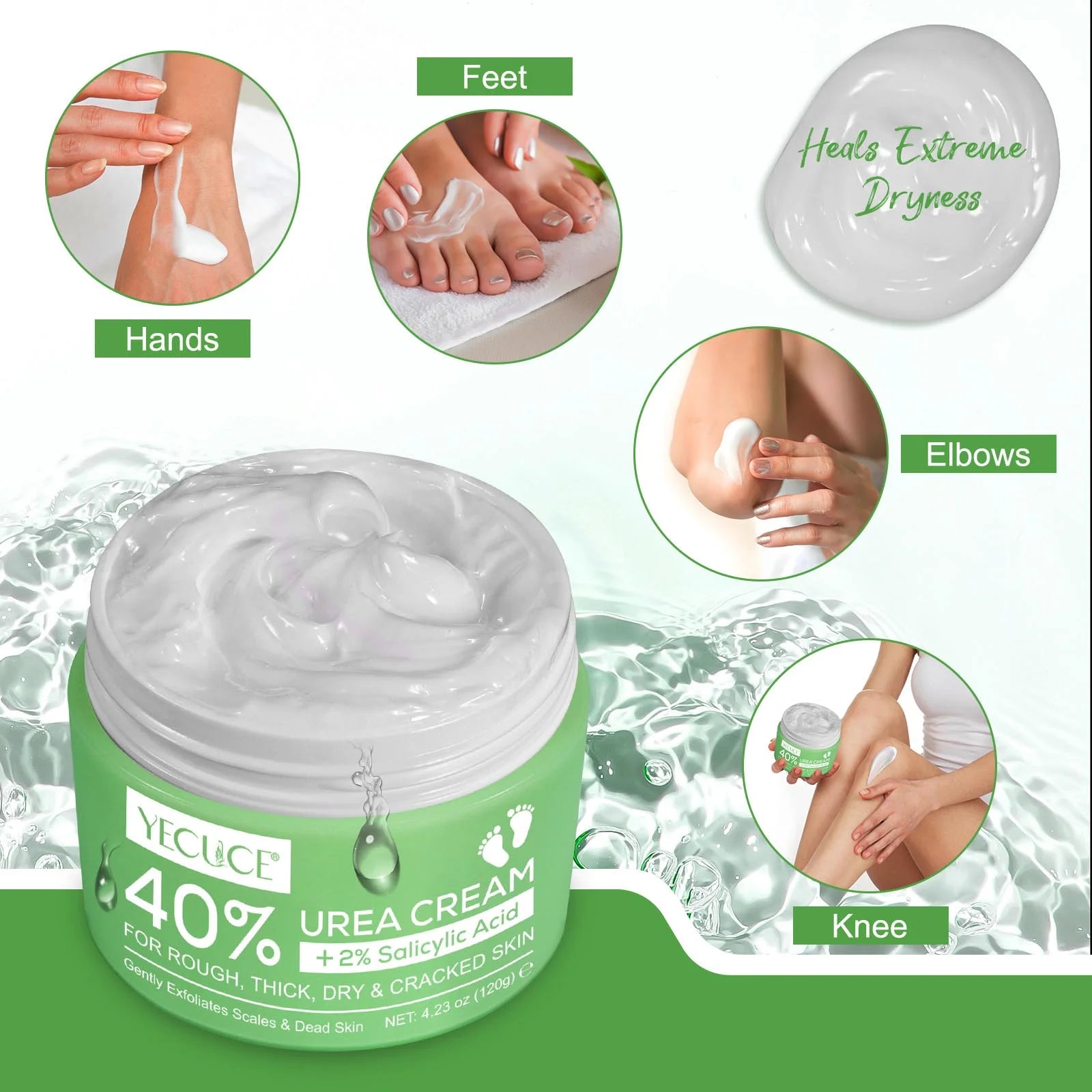 40% Urea Cream 2% Salicylic Acid (4.23Oz/120G), Foot Cream Hand Lotion for Rough Dry Cracked Skin - Callus Dead Skin Remover - Tea Tree & Aloe Vera