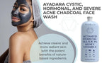 Acne Face Wash with Charcoal & Sulfur, Cystic & Hormonal Acne Cleanser, 8 Fl Oz,