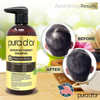 Advanced Therapy Biotin Shampoo 16 Fl Oz