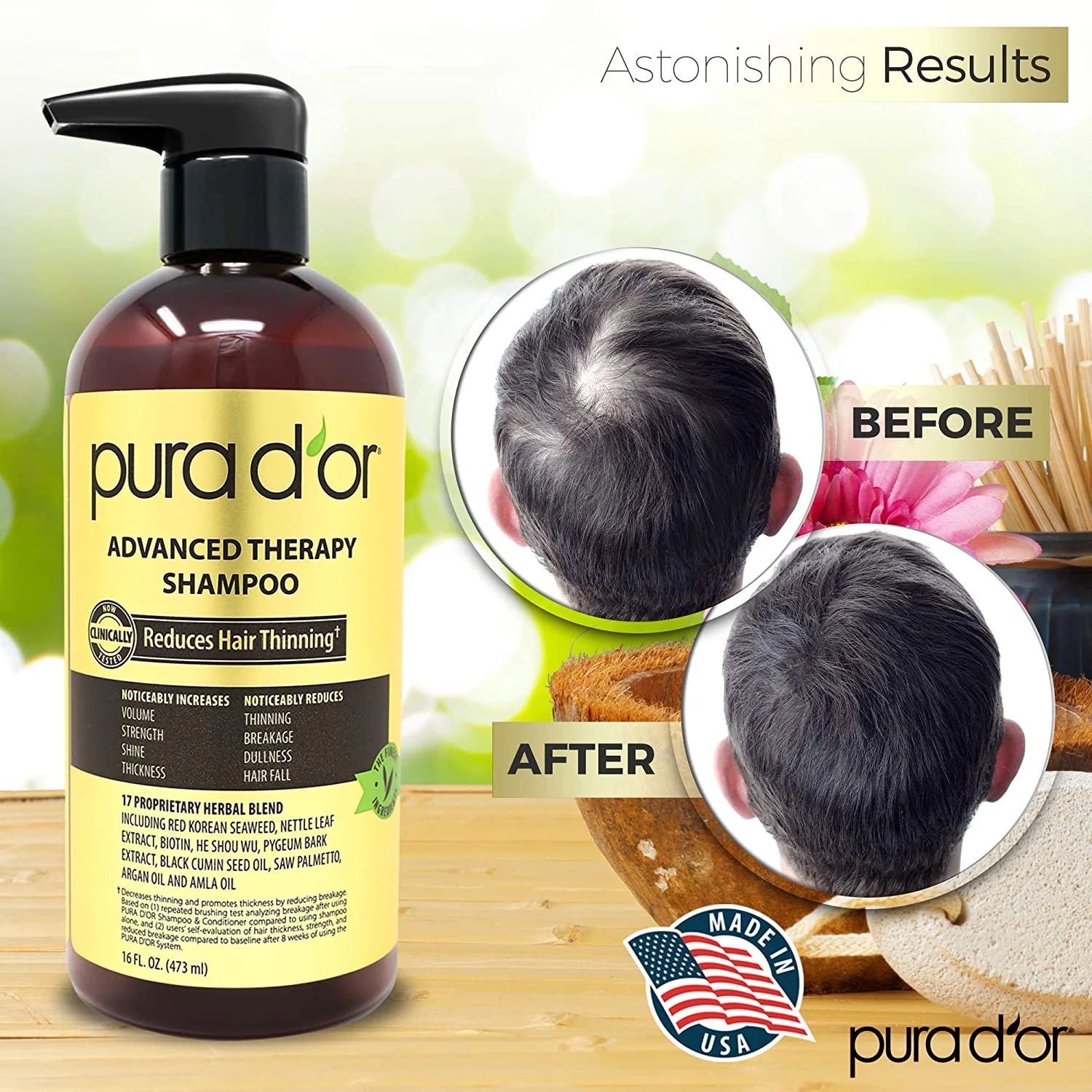 Advanced Therapy Biotin Shampoo 16 Fl Oz
