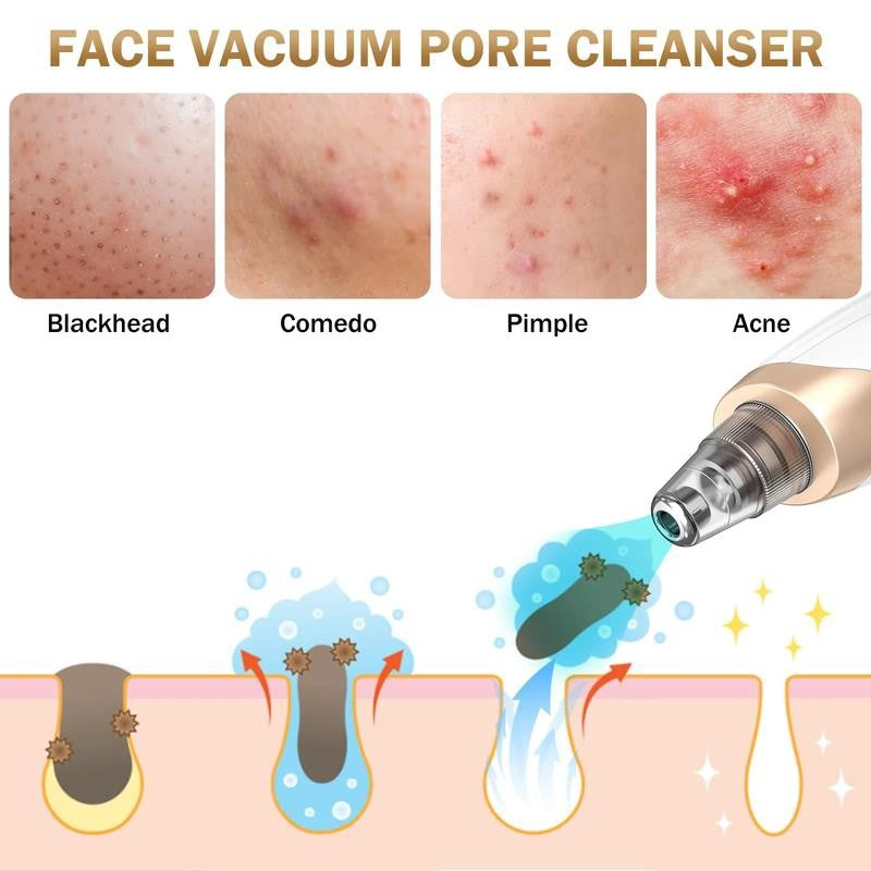 Blackhead Remover Vacuum Pore Extractor Kit - Blackhead Extractor Tool with 3 Ad