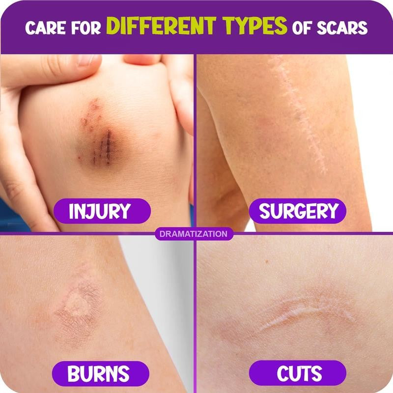Advanced Scar Gel for Kids, Hypoallergenic Scar Treatment, Grape Scent, 1 Oz