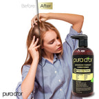 Advanced Therapy Biotin Conditioner 16 Fl Oz