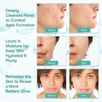 Collagen Cleansing Milk for Face, Vegan Facial Cleanser for Women and Men, Micel