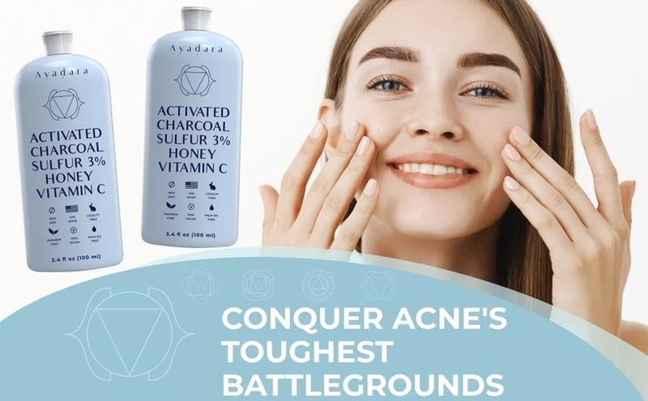 Acne Face Wash with Charcoal & Sulfur, Cystic & Hormonal Acne Cleanser, 8 Fl Oz,