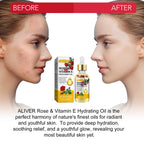 Aliver Rose & Vitamin E Oil for Face, 100% Pure and Natural , for Skin Moisturizing, Anti-Aging, Reduce Pigmentation, 2.02 Fl Oz