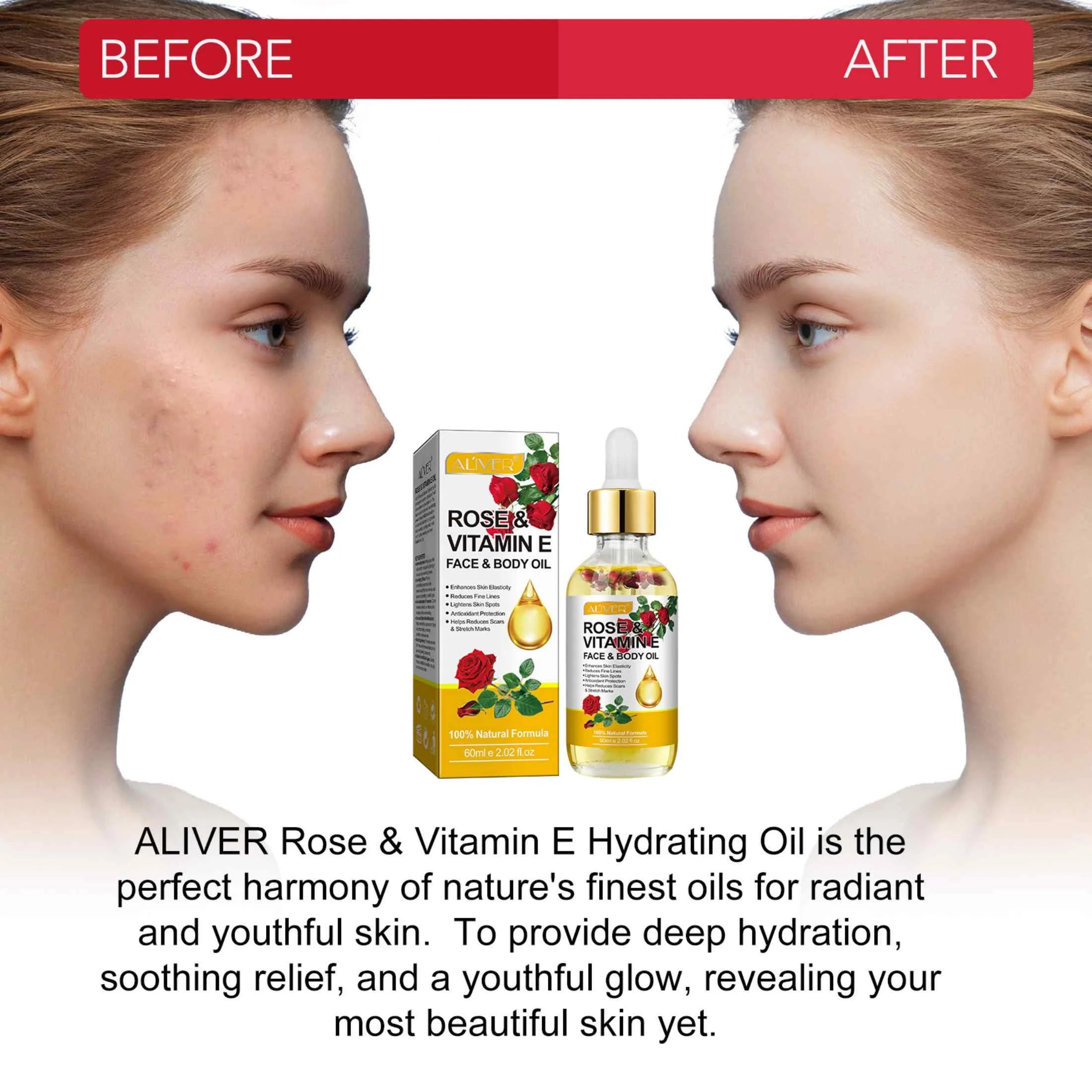 Aliver Rose & Vitamin E Oil for Face, 100% Pure and Natural , for Skin Moisturizing, Anti-Aging, Reduce Pigmentation, 2.02 Fl Oz
