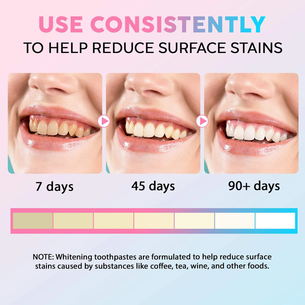 3-Pack Teeth Whitening Toothpaste with Niacinamide, Fresh Breath Toothpastes, Remove Tooth Stains, Enamel Safe
