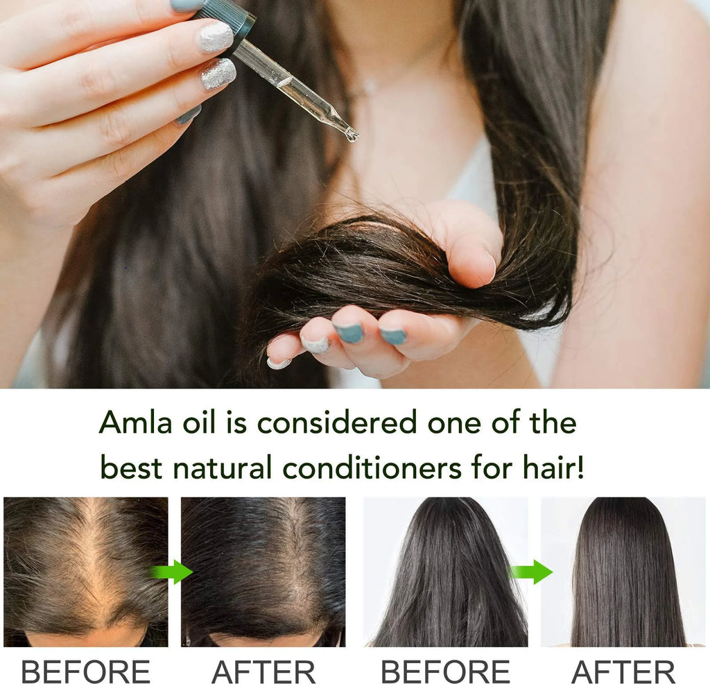 Amla Oil for Hair Care, Hair Oiling, Scalp Massage & Skin Care, Moisturizing & Nourishing, 100% Pure & Natural, Cold Pressed, Cruelty Free, 2.02 Fl Oz