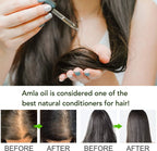 Amla Oil for Hair Care, Hair Oiling, Scalp Massage & Skin Care, Moisturizing & Nourishing, 100% Pure & Natural, Cold Pressed, Cruelty Free, 2.02 Fl Oz