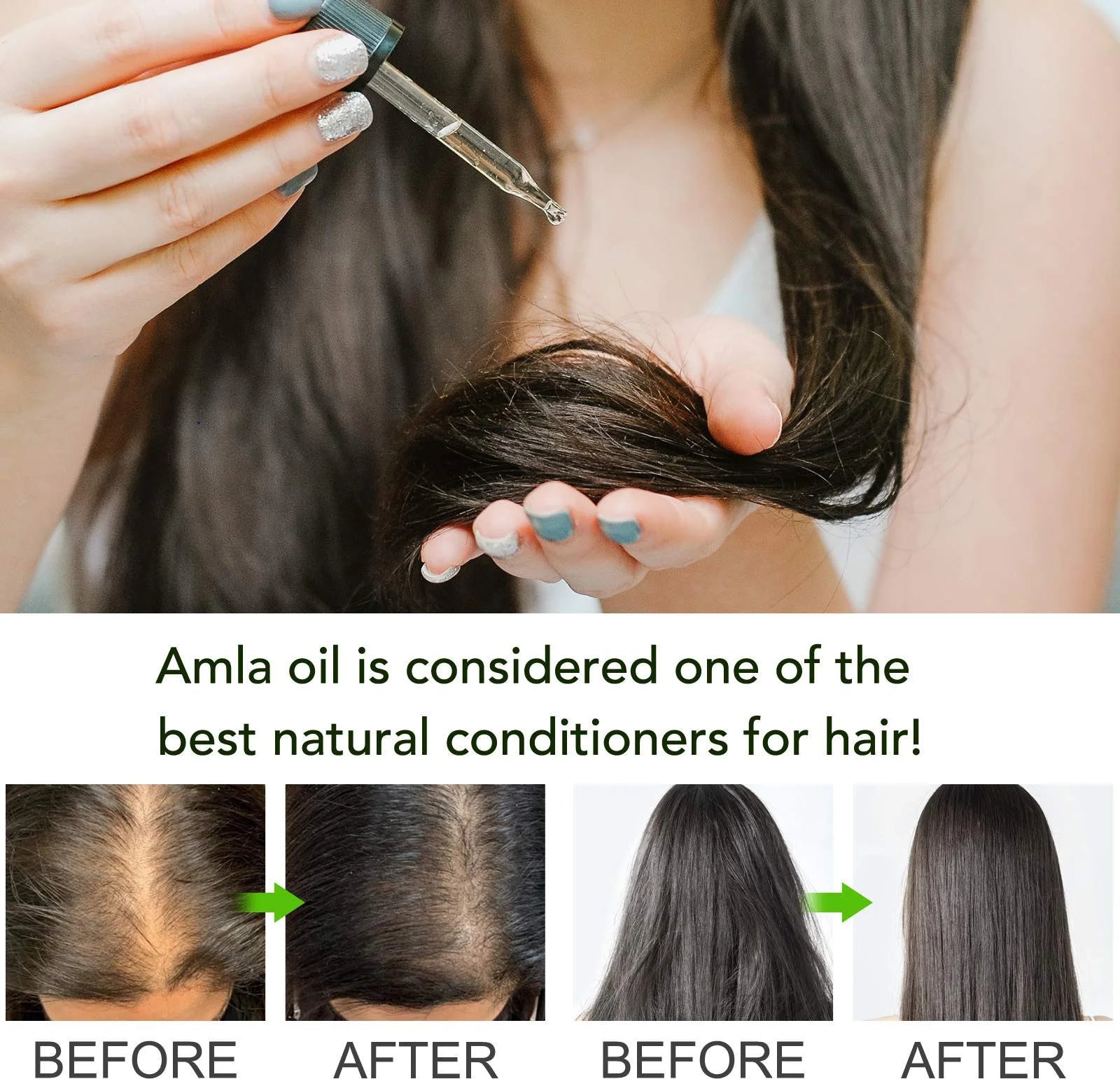 Amla Oil for Hair Care, Hair Oiling, Scalp Massage & Skin Care, Moisturizing & Nourishing, 100% Pure & Natural, Cold Pressed, Cruelty Free, 2.02 Fl Oz