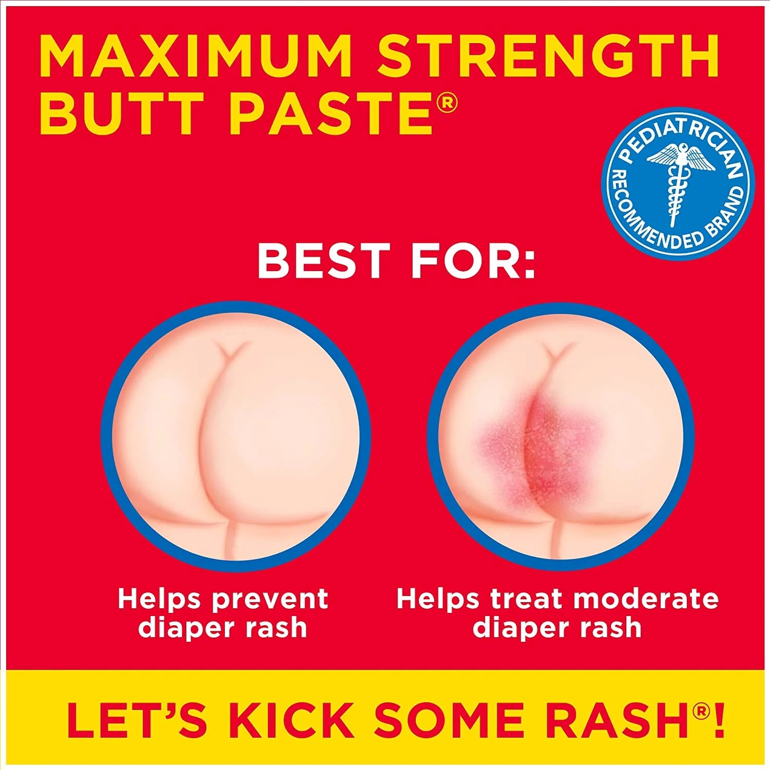 Boudreaux'S Butt Paste Maximum Strength Diaper Rash Cream, Ointment for Baby, 4 Oz Tube