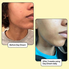 Day Dream Serum with Vit C & Niacinamide, Even Tone & Dark Spots, All Skin Types