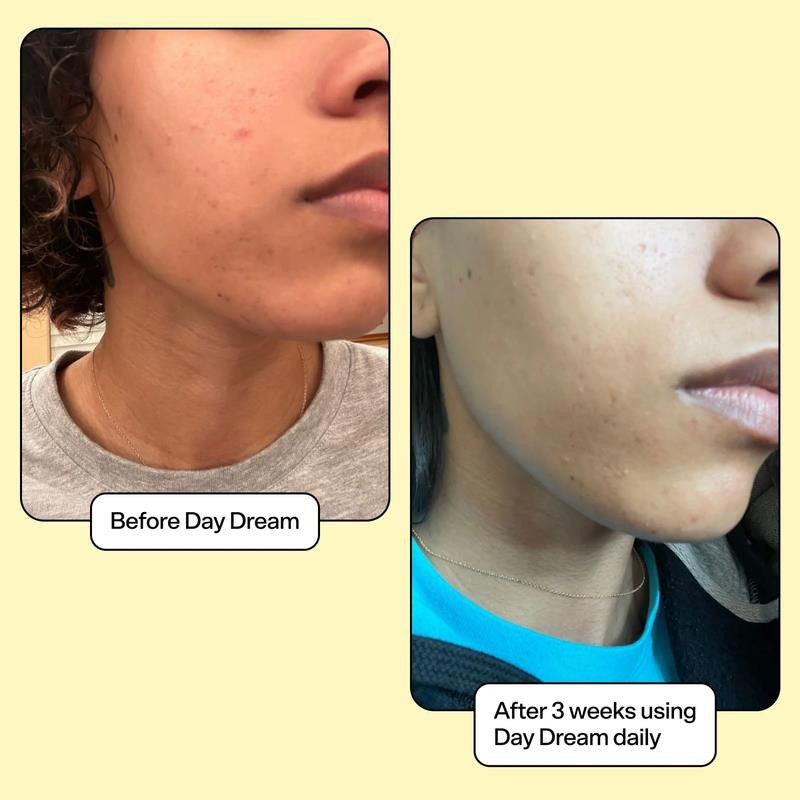 Day Dream Serum with Vit C & Niacinamide, Even Tone & Dark Spots, All Skin Types