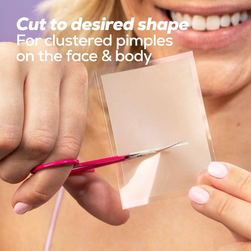 (2 Pack) Custom Blemish Patch with Hydrocolloid, Non Medicated, for All Ski Typ