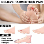 3 Pairs Toe Separators, Correcting Bunions and Restoring Toes to Their Original