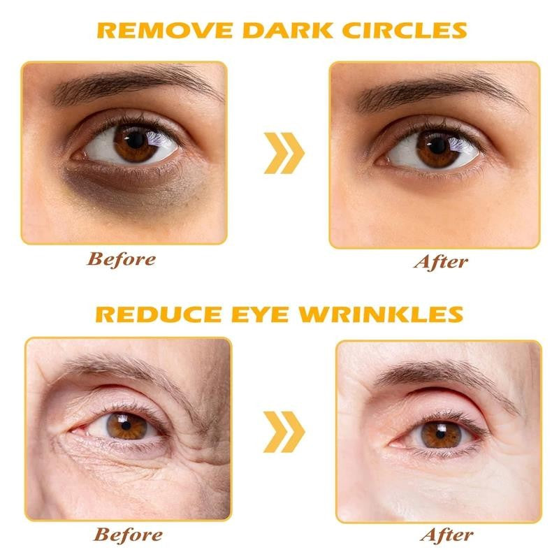Golden Eye Mask, 30 Pairs under Eye Masks for Dark Circles and Puffiness, Under