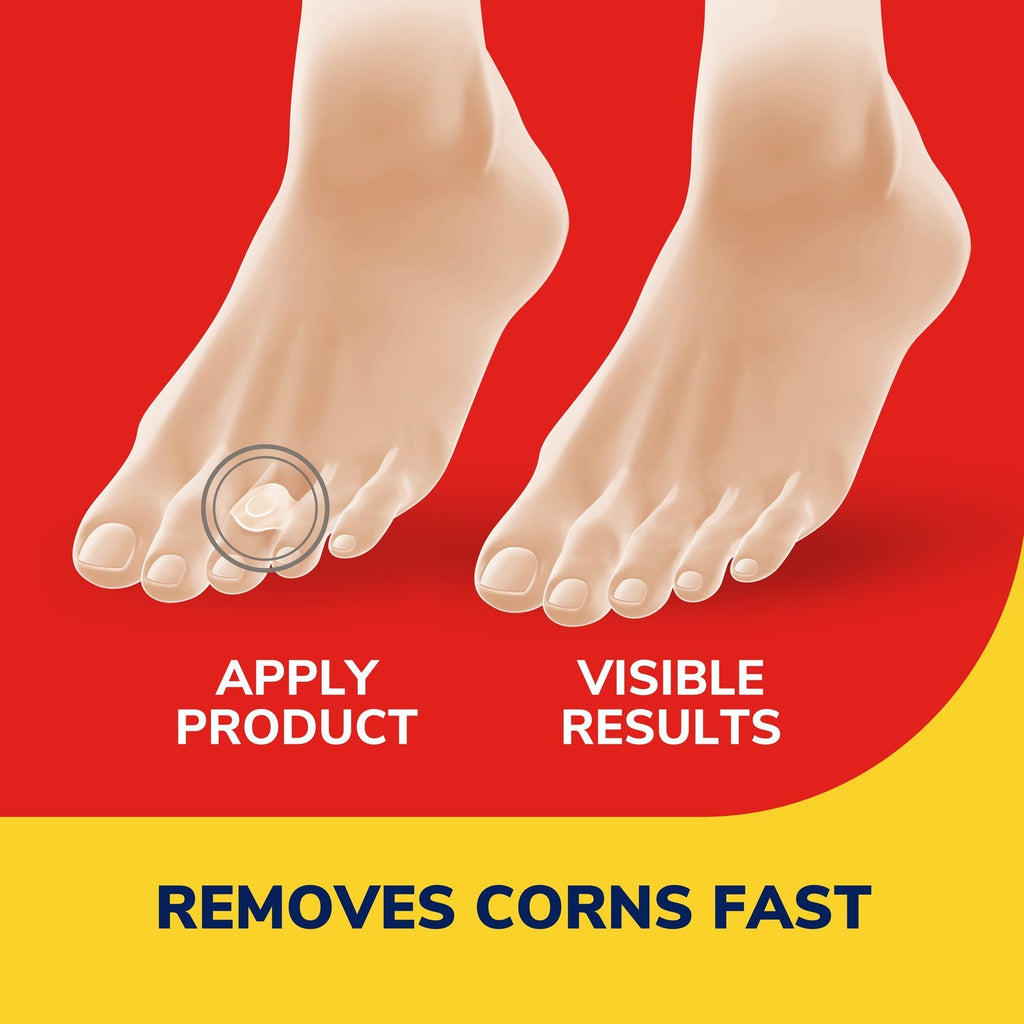 Corn Remover Pads Remover Cushions, 9 Count