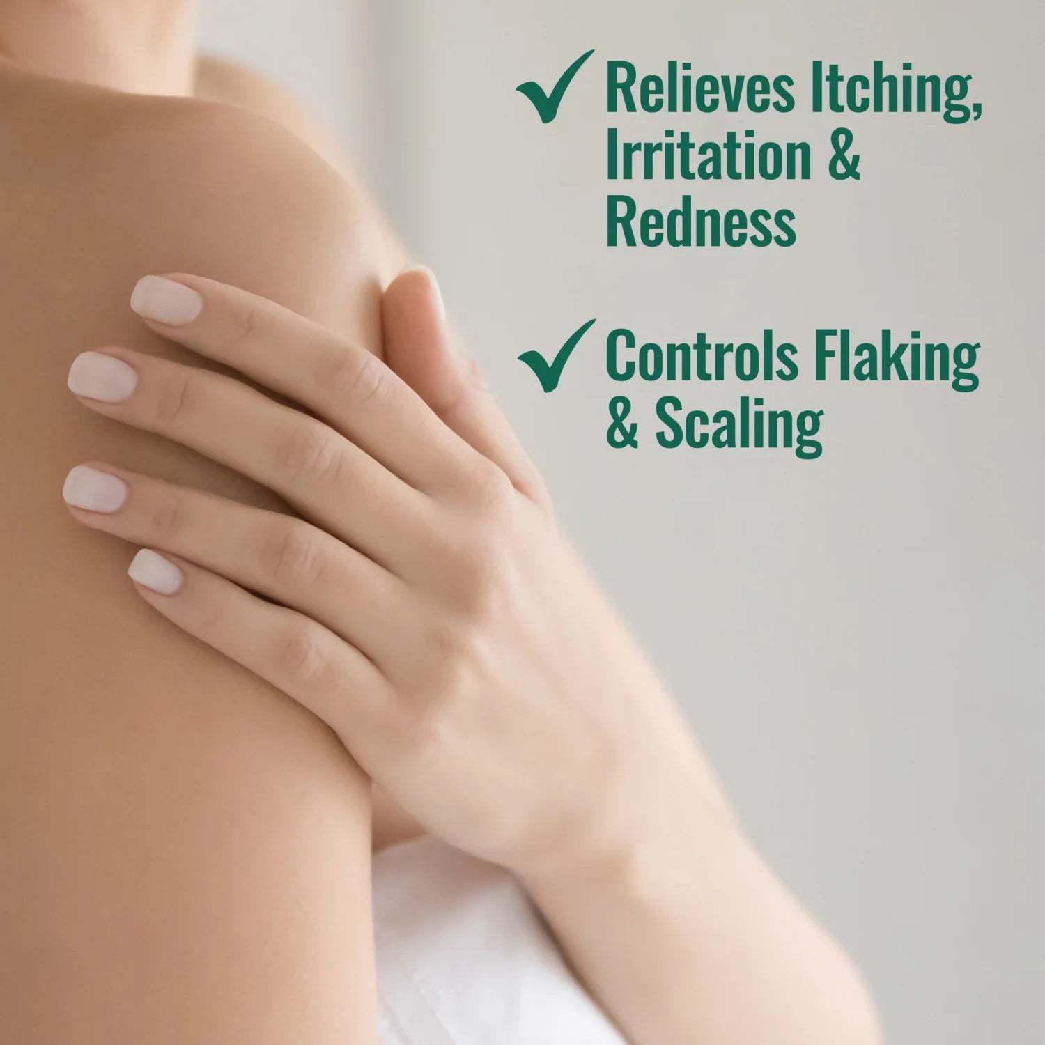 Nizoral Psoriasis Relief Cream Relieves Itch Redness & Controls Flaking & Scaling (Salicylic Acid 3%)
