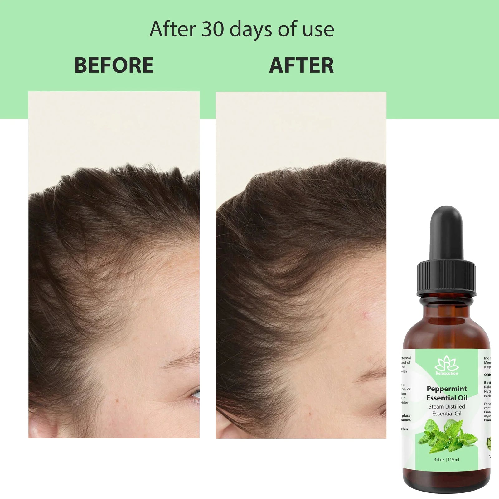 100% Pure Peppermint Essential Oil – Natural & Therapeutic Grade for Aromatherap