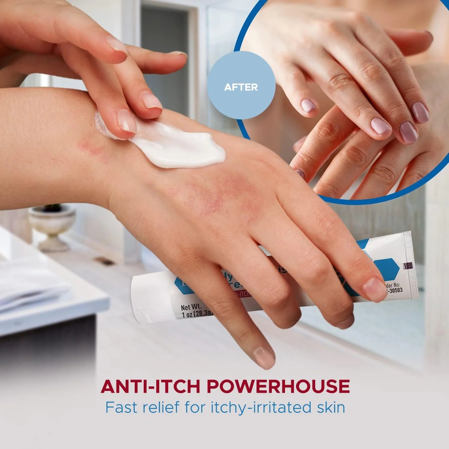 MEDPRIDE Hydrocortisone Cream 1% Dermatitis Cream anti Itch Cream for Itchy Skin Relief, 1 Oz