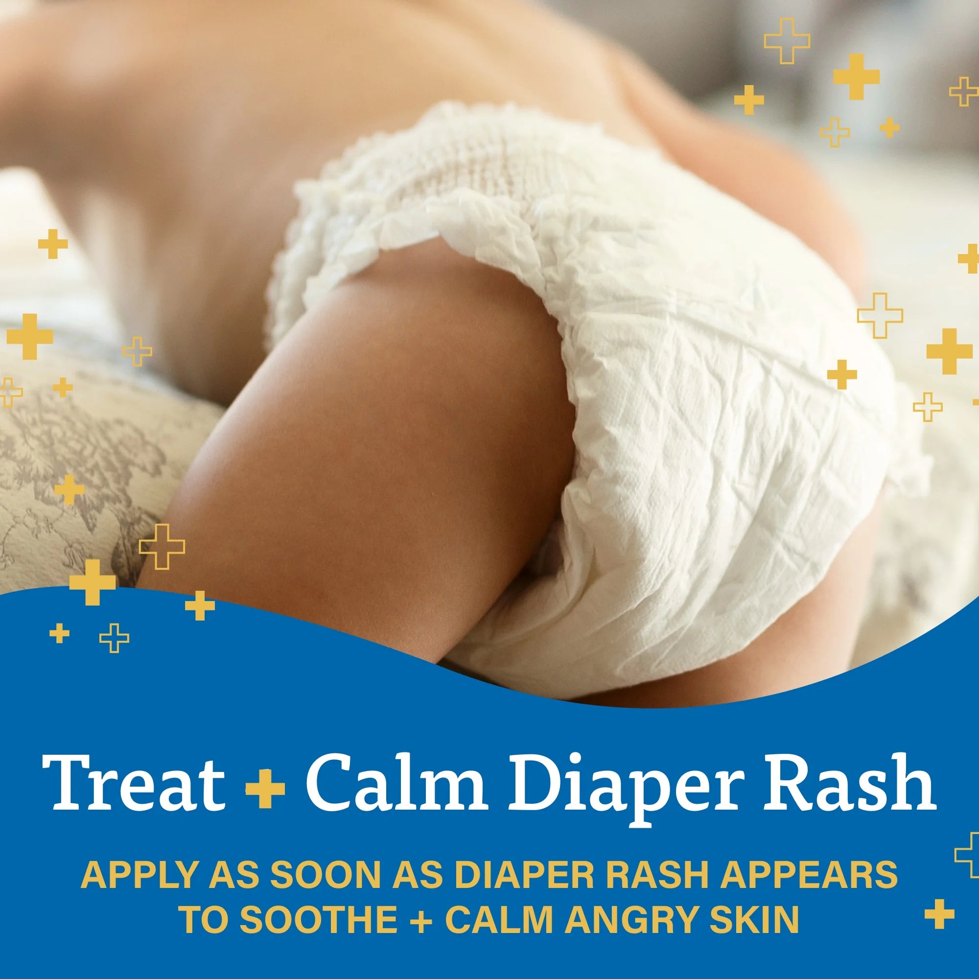 A+D Treat & Heal Diaper Rash Cream, Zinc Oxide 10%, Easy Spreading Diaper Rash Cream for Baby, 16 Oz
