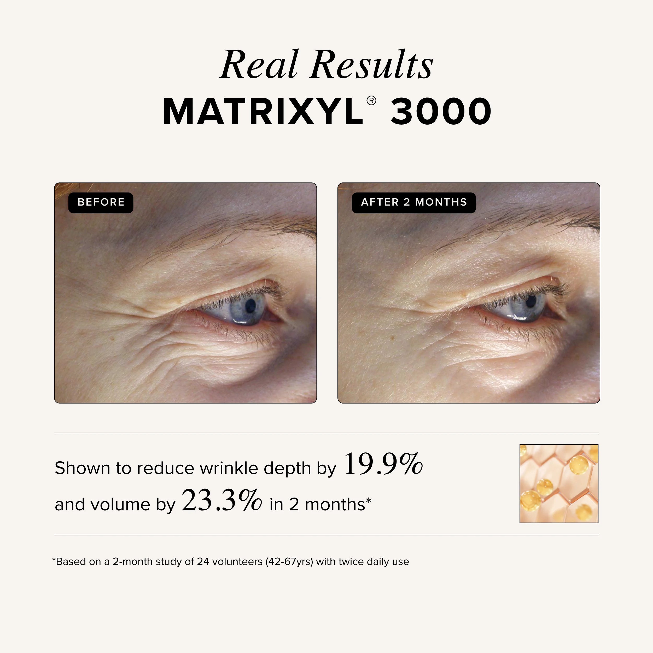 Asterwood Triple Repair Matrixyl 3000 + Argireline + Hyaluronic Acid + Organic Vitamin C Serum for Face; Anti-Aging Face Serum, Anti-Wrinkle Serum, Facial Skin Serum Skin Care, 29Ml/1 Oz