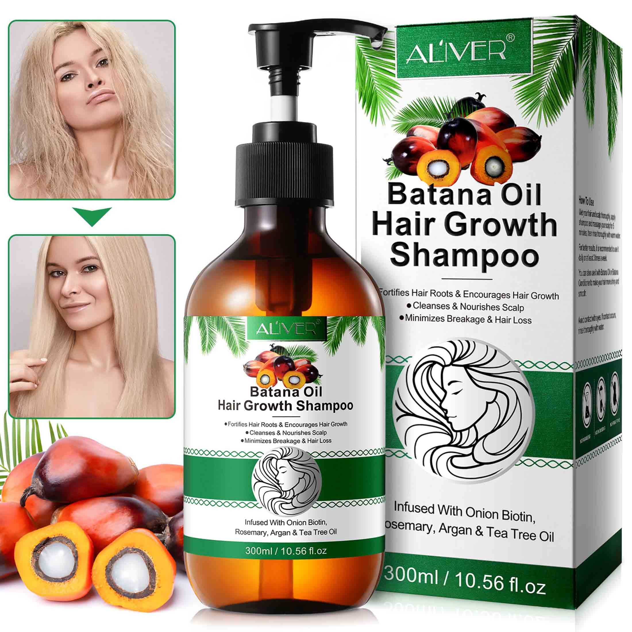 Aliver Batana Oil Shampoo,Pure Plant Extracts,Cleanses & Nourishes Scalp,For All Hair Type ,10.56Fl.Oz
