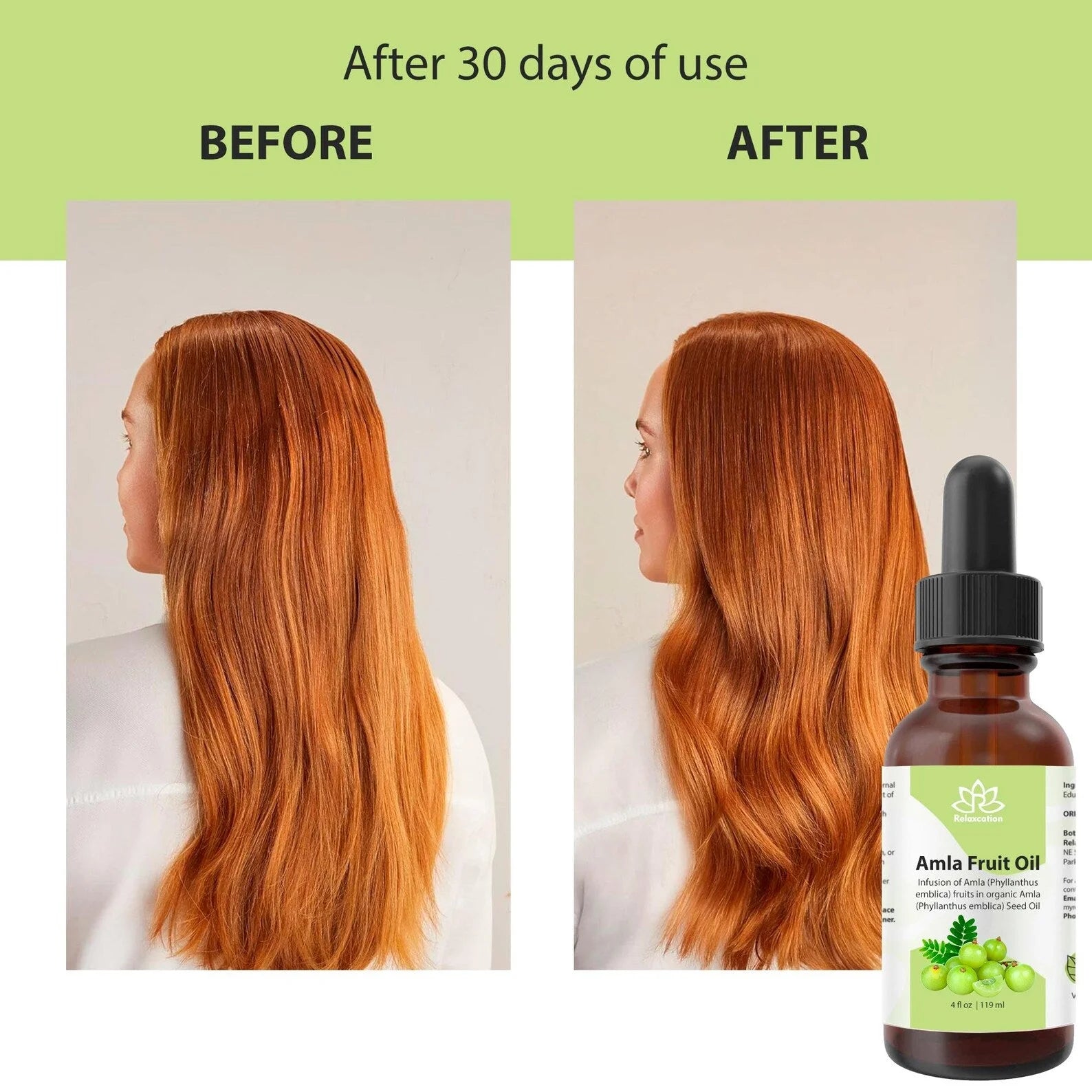 Amla Fruit Oil (0,5Oz)