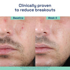 Gentle Clear Complexion-Cle