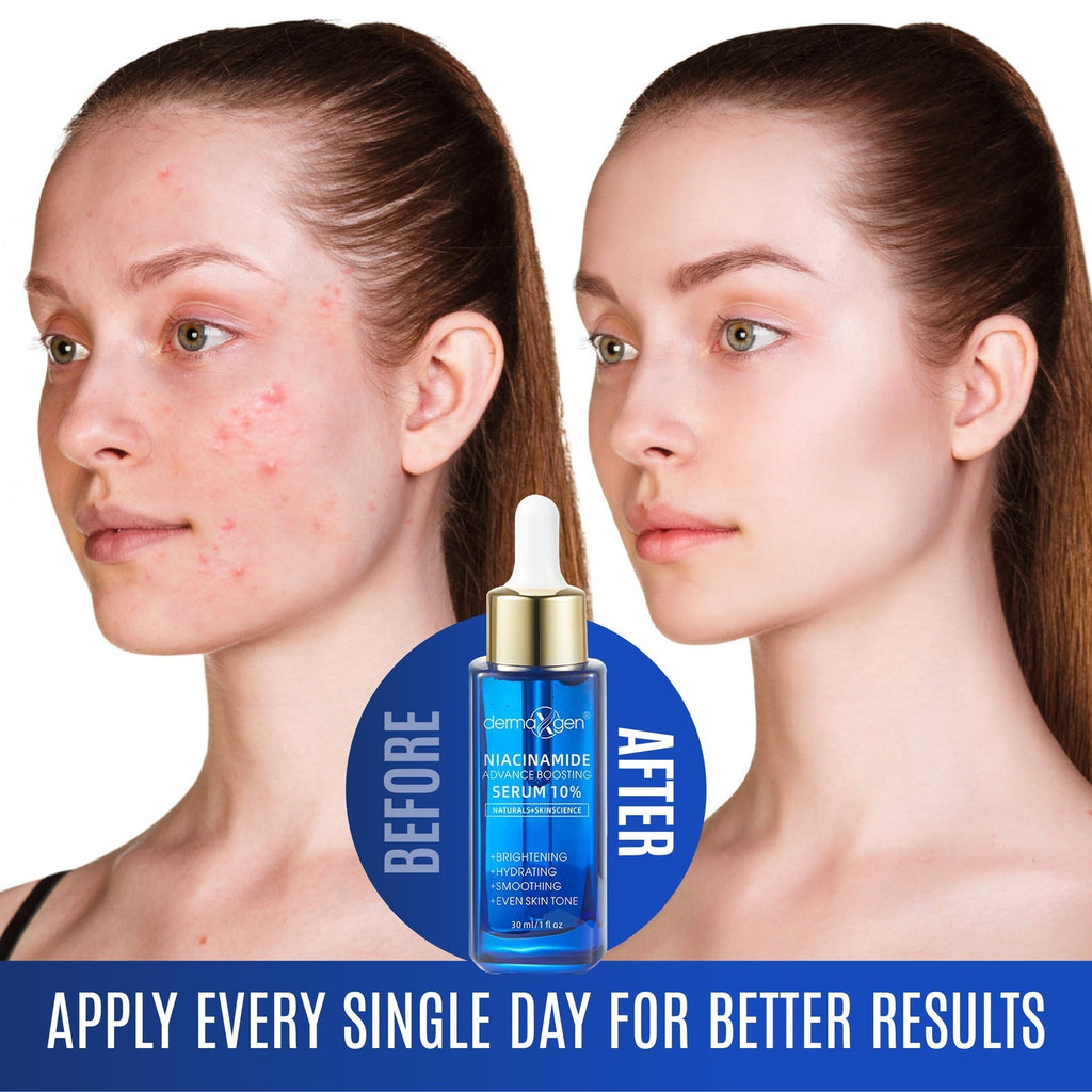 10% Niacinamide Serum for Smooth, Bright & Youthful Skin, Pore Reducer + Uneven