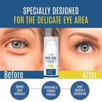 Eye Gel + Plant Stem Cells + Matrixyl 3000 + EYE BAG REMOVER, Arginine for Under
