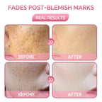5% Niacinamide Serum, Face Serum for Wrinkles, Dark Spots, and Anti-Aging with V