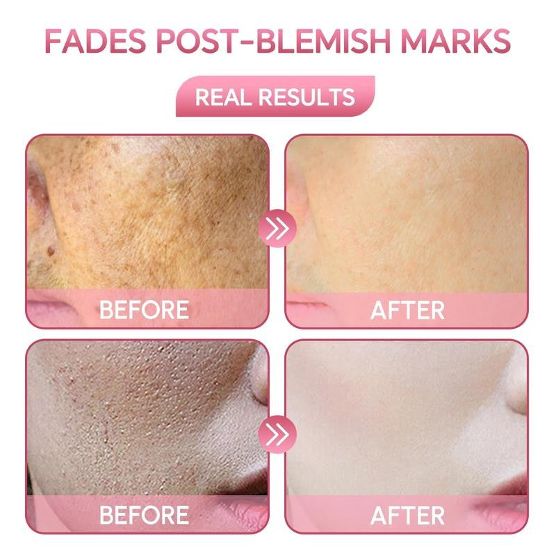 5% Niacinamide Serum, Face Serum for Wrinkles, Dark Spots, and Anti-Aging with V