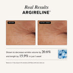 Asterwood Triple Repair Matrixyl 3000 + Argireline + Hyaluronic Acid + Organic Vitamin C Serum for Face; Anti-Aging Face Serum, Anti-Wrinkle Serum, Facial Skin Serum Skin Care, 29Ml/1 Oz