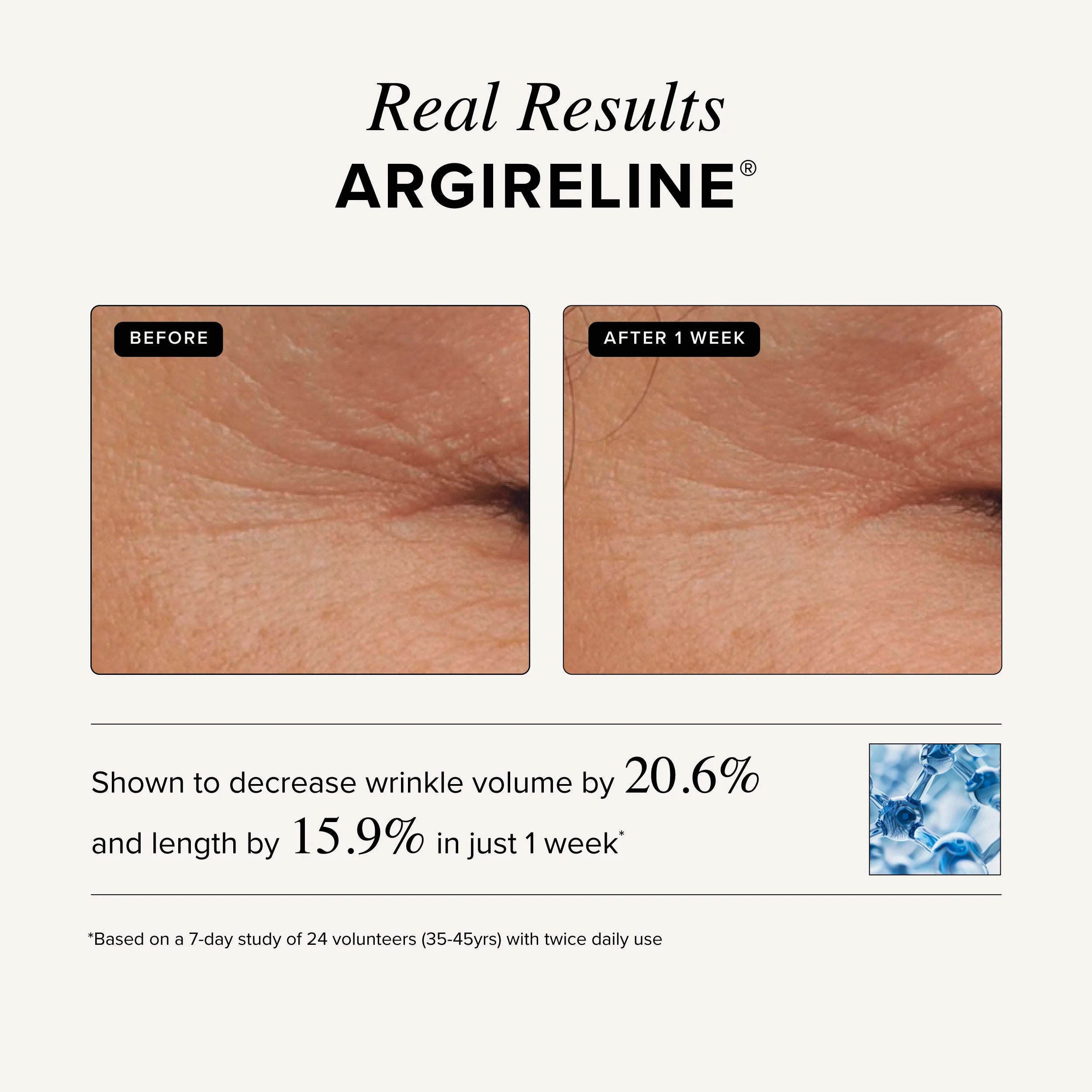 Asterwood Triple Repair Matrixyl 3000 + Argireline + Hyaluronic Acid + Organic Vitamin C Serum for Face; Anti-Aging Face Serum, Anti-Wrinkle Serum, Facial Skin Serum Skin Care, 29Ml/1 Oz
