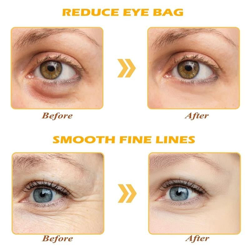 Golden Eye Mask, 30 Pairs under Eye Masks for Dark Circles and Puffiness, Under