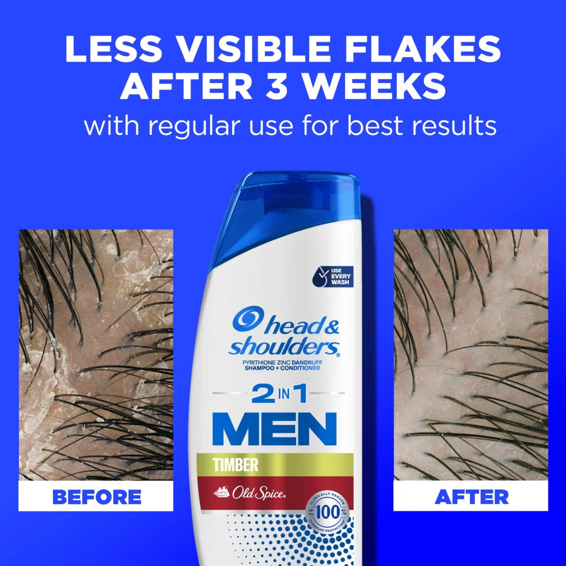 Head and Shoulders Mens 2In1 Dandruff Shampoo and Conditioner, plus Old Spice Timber, 12.5 Oz