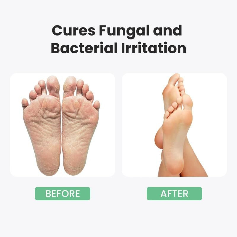 Athletes Foot Treatment Extra Strength - 8.82Oz Foot Cream with Tea Tree Oil & A