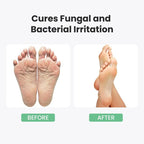 Athletes Foot Treatment Extra Strength - 8.82Oz Foot Cream with Tea Tree Oil & A