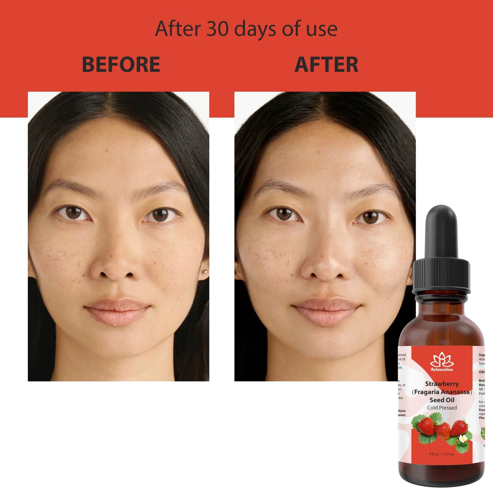 100% Pure Strawberry Seed Oil – Cold Pressed, Natural Moisturizer for Skin, Hair