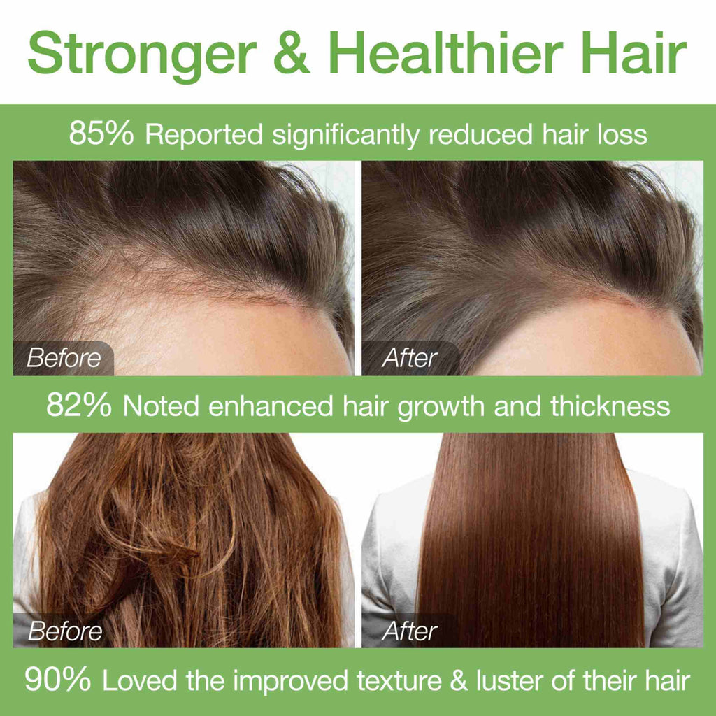 Batana Hair Oil,100% Pure and Natural,Nourishing Moisturizing Conditioner, for Men & Women(150G/5.3Oz)