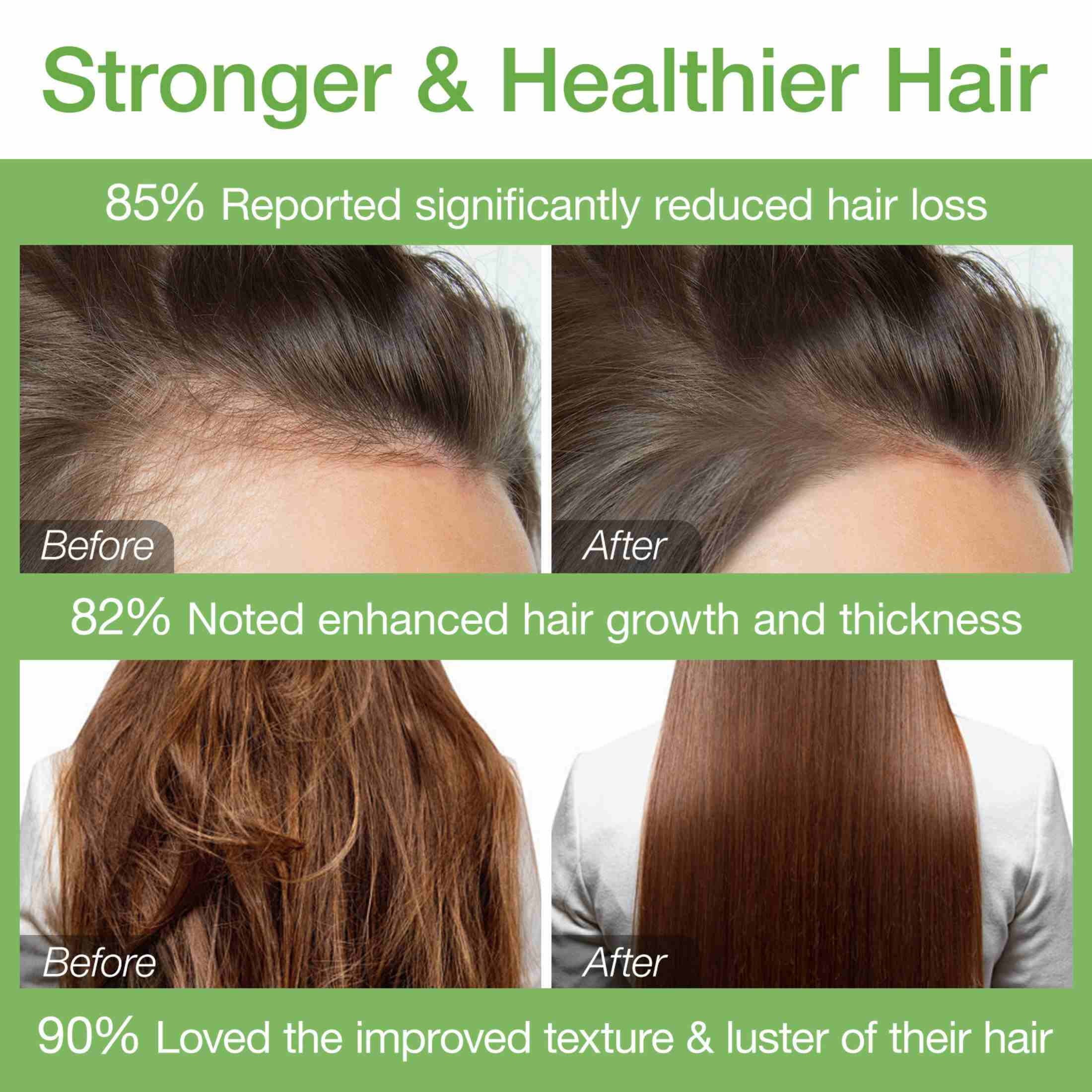 Batana Hair Oil,100% Pure and Natural,Nourishing Moisturizing Conditioner, for Men & Women(150G/5.3Oz)