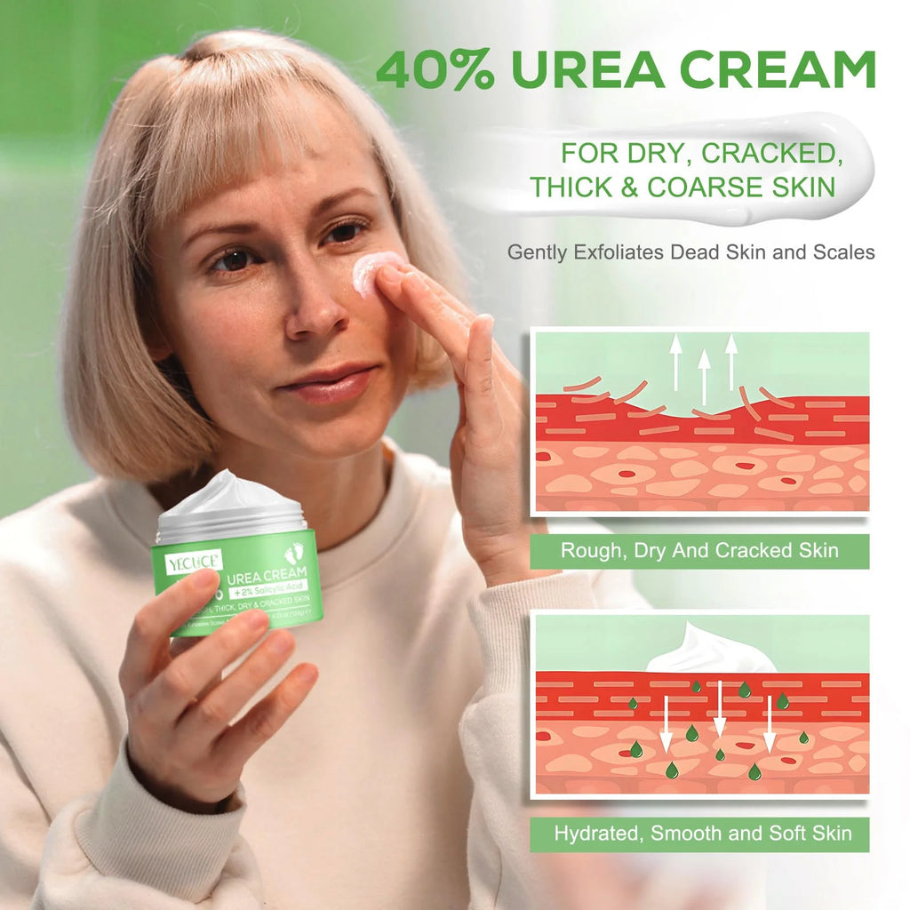 40% Urea Cream 2% Salicylic Acid (4.23Oz/120G), Foot Cream Hand Lotion for Rough Dry Cracked Skin - Callus Dead Skin Remover - Tea Tree & Aloe Vera